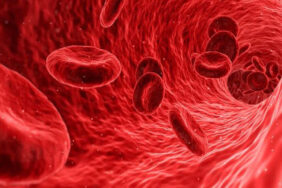 Kansızlık Nedir? Belirtileri Nelerdir? Nasıl Beslenmeliyim?