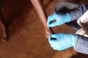 Maymun Çiçeği: Nedir, Nasıl Bulaşır ve Önlemler Nelerdir?