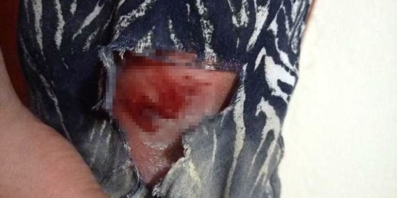 Elazığ’da Başıboş Köpekler Tarafından Kovalanan Şahıs Yaralandı Elazığ’da Başıboş Köpekler Tarafından Kovalanan Şahıs Yaralandı