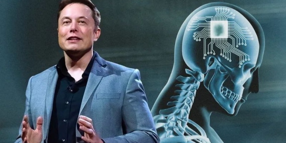 Elon Musk: Önümüzdeki 10 Yılda Milyonlarca İnsana Neuralink Çipi Takacağız Elon Musk: Önümüzdeki 10 Yılda Milyonlarca İnsana Neuralink Çipi Takacağız