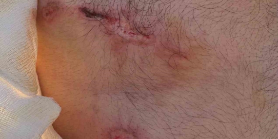 Elazığ’ın Palu İlçesinde Ayı Saldırısı