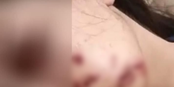 Yüzüne Maytap Isabet Eden Genç Kızın Dramı Yüzüne Maytap Isabet Eden Genç Kızın Dramı