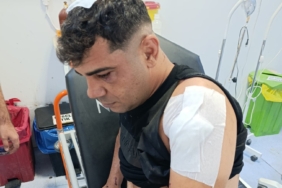 is-gorusmesi-korkusuyla-yuzlesen-genc-hayatini-kil-payi-kurtardi-AjlJbEvx.jpg