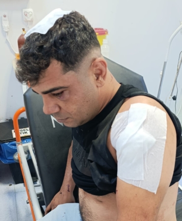 is-gorusmesi-korkusuyla-yuzlesen-genc-hayatini-kil-payi-kurtardi-AjlJbEvx.jpg