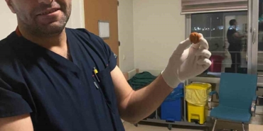 Ağrı'da Şaşırtan Olay: Yutulmuş Ceviz Yemek Borusundan Çıkarıldı agrida-sasirtan-olay-yutulmus-ceviz-yemek-borusundan-cikarildi-jKILPR5H.jpg