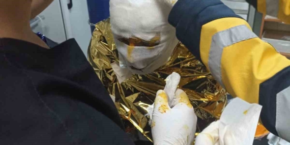 Erzincan’daki Kömür Ocağında Meydana Gelen Yangında 2 İşçi Yaralandı