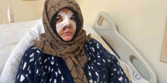 Dehşet Anları: Kocasının Şiddetine Maruz Kalan Kadının Korkunç Hikayesi