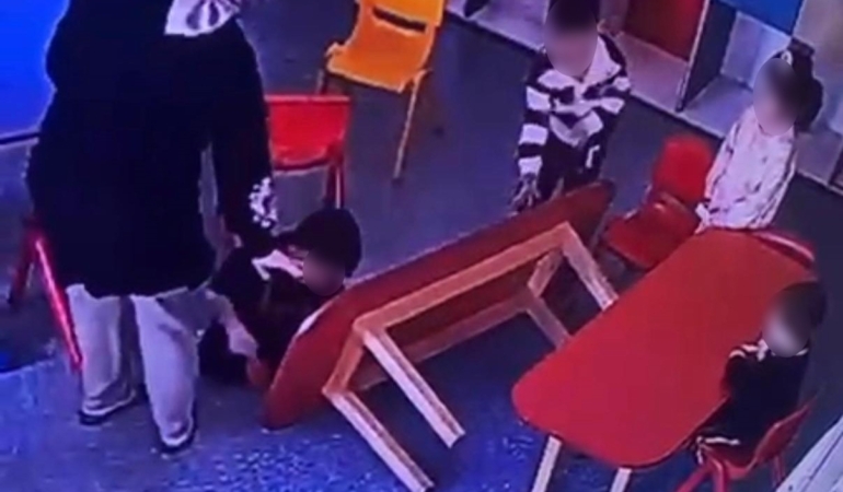 ozel-okulda-sok-edici-goruntu-cocugun-parmaklari-nasil-hale-geldi-hcN1je8K.jpg