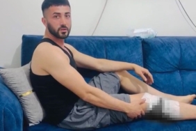 nizipte-basibos-kopek-saldirisinda-yaralanan-iki-kisiden-belediye-tepkisi-3GdDs3We.jpg