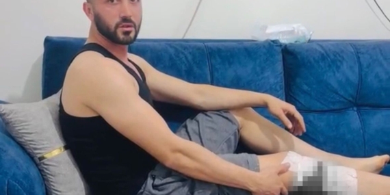 Nizip’te Başıboş Köpek Saldırısında Yaralanan İki Kişiden Belediye Tepkisi