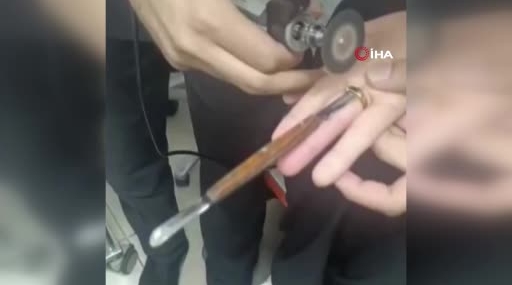 İtfaiye Ekipleri Hastanede Hayati Müdahalede Bulundu: Parmaklığı Sıkıştıran Yüzük Başarıyla Çıkarıldı