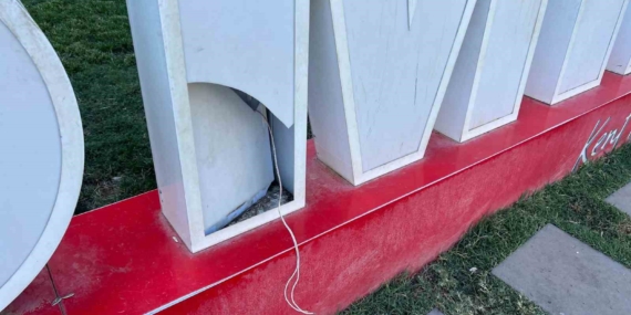 4 Yaşındaki Çocuk Elektrik Akımına Kapılarak Yaralandı