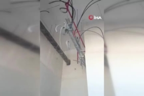 Adıyaman'da Sokak Köpeklerinin Saldırısına Uğrayan 4,5 Yaşındaki Çocuk Ağır Yaralandı